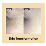 Medi-Peel Hyaluronic Volumizing Eye Cream Oogkrém a szem környékére