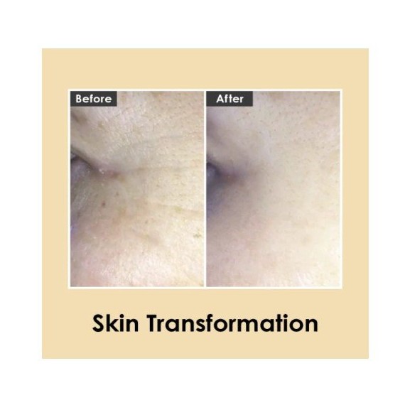 Medi-Peel Hyaluronic Volumizing Eye Cream Oogkrém a szem környékére