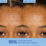 Caudalie Vinoperfect Nappali arckrém sötét foltok ellen