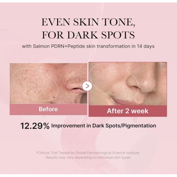 Medicube PDRN Pink Cica Soothing Toner Nyugtató arctonik