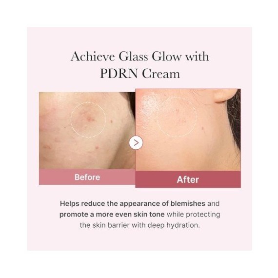 Medicube PDRN Pink Hyaluronic Moisturizing Cream Hidratáló arckrém
