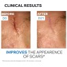 Uriage Bariederm Cica Repairing Cream With D-Panthenol And Copper-Zinc Regeneráló arckrém