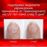 Essie To The Rescue Nail Repair Körömerősítő