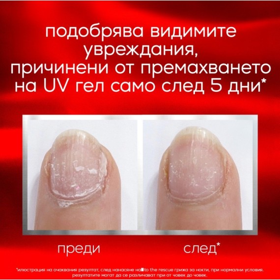 Essie To The Rescue Nail Repair Körömerősítő