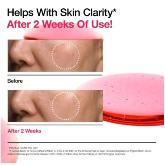 Anua Niacinamide 10% + TXA 4% Serum Arcszérum