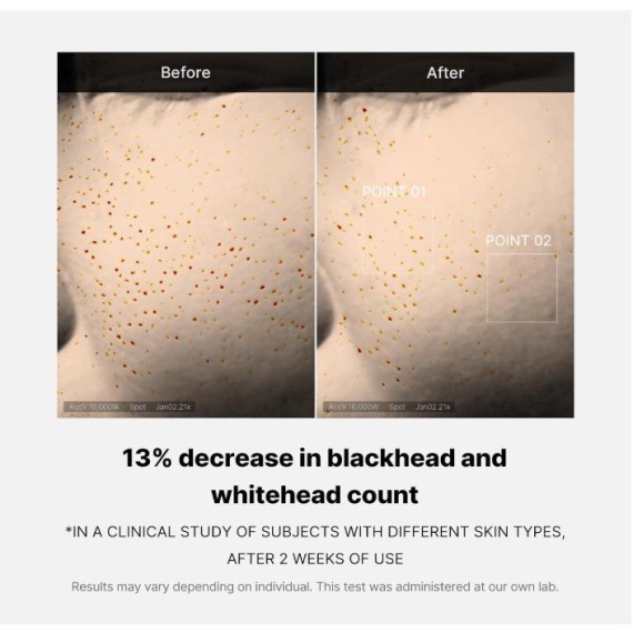 Medicube Zero Pore One Day Serum Arcszérum