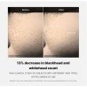Medicube Zero Pore One Day Serum Arcszérum